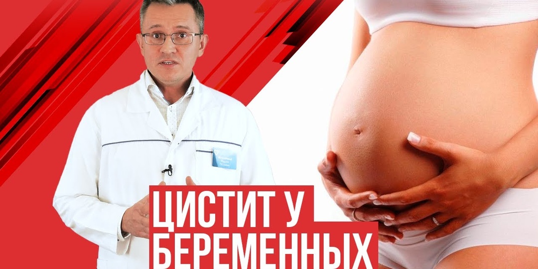 Цистит у беременных: какие симптомы самые опасные