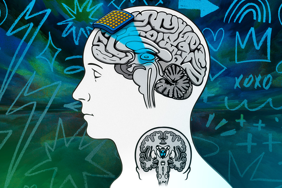 Неинвазивный метод визуализации головного мозга может помочь исследователям получить знания о человеческом сознании. Источник — MIT.