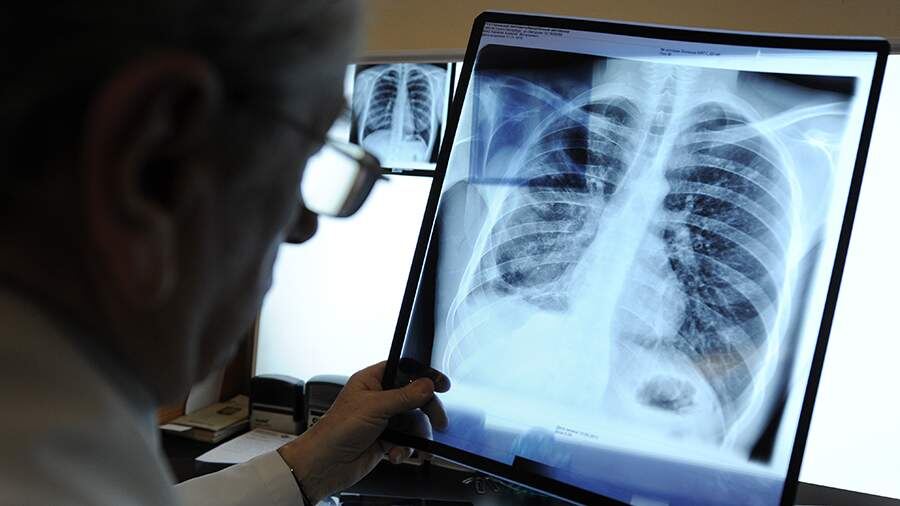    Фото: ИТАР-ТАСС/ Руслан Шамуков