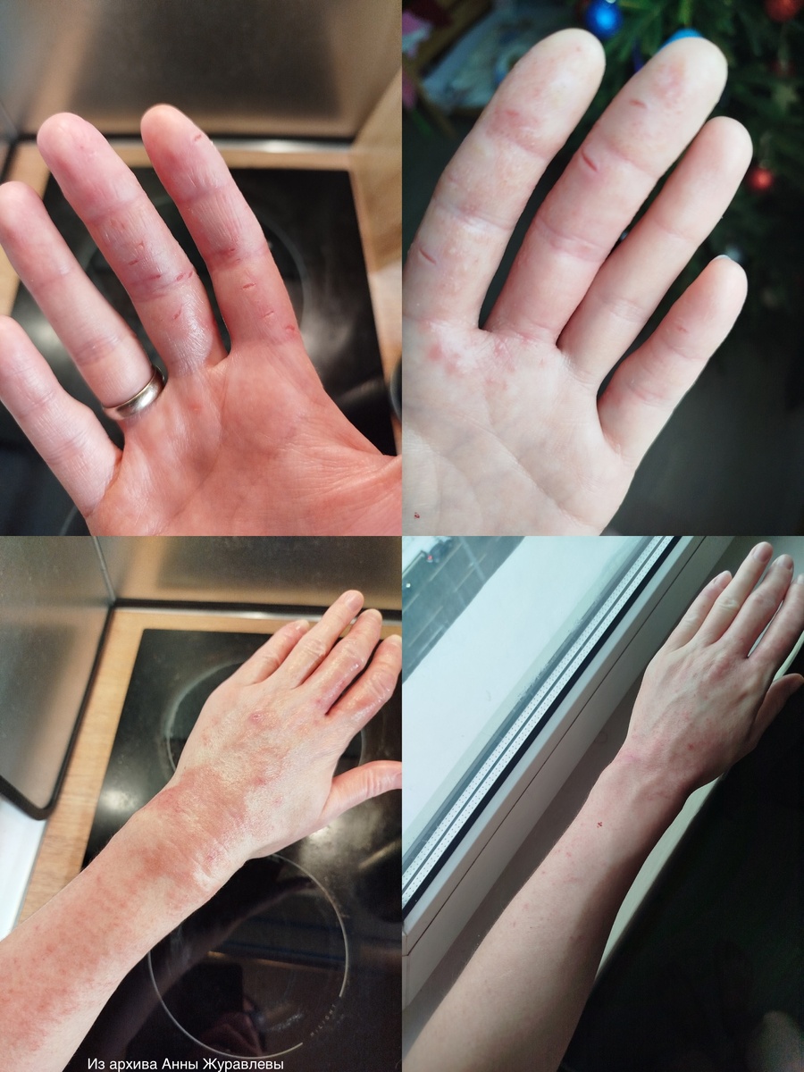 Фото из архива Анны Журавлевой 