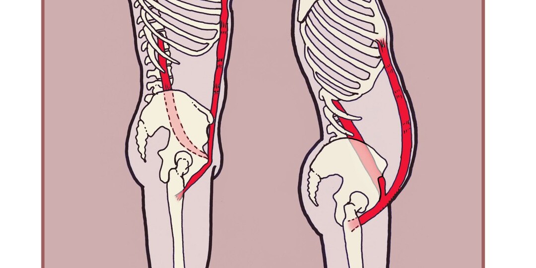 Выпирает живот? Настоящая причина — в тазе. 4 упражнения для осанки, которые работают в любом возрасте