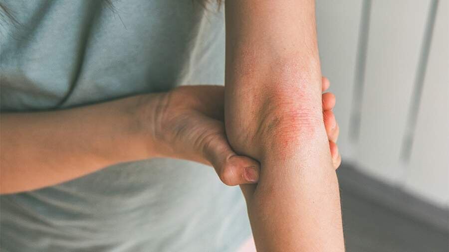    Фото: Global Look Press/IMAGO/Zoonar.com/Evgeniia Gordee