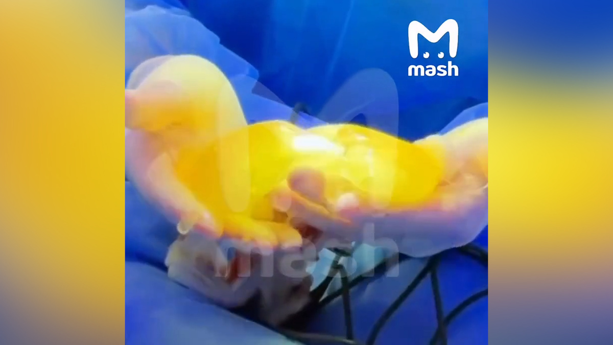    Силиконовая грудь взорвалась у девушки-блогера из Уфы во время тренировки