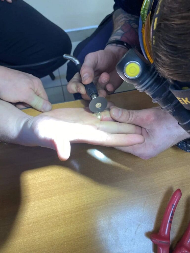     В Оренбурге спасатели сняли с мужчины застрявшее обручальное кольцо Оренбуржье
📷    В Оренбурге спасатели сняли с мужчины застрявшее обручальное кольцо Оренбуржье
