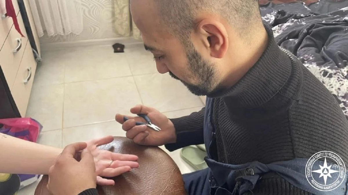    В Уфе спасатели помогли девушке снять кольцо с пальца