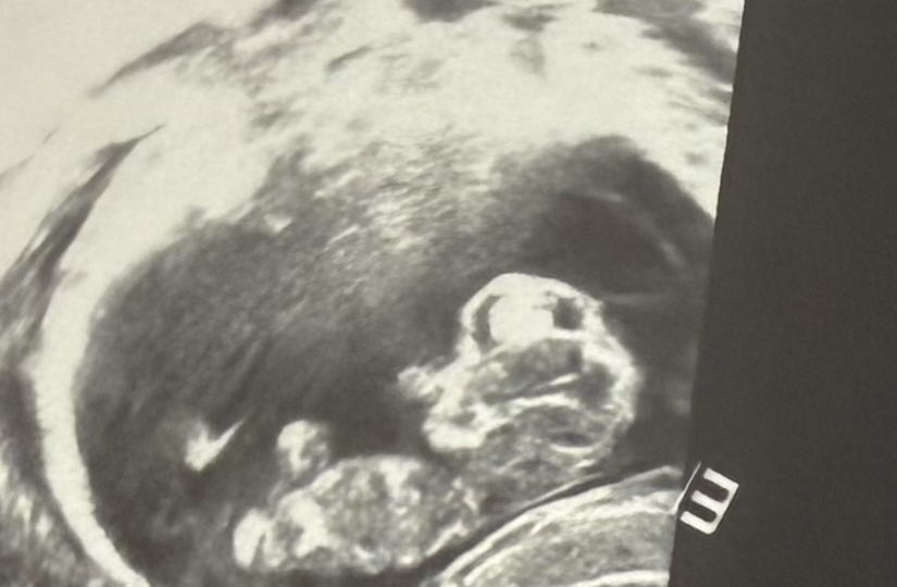 Прерванный половой акт = прерванная карьера?