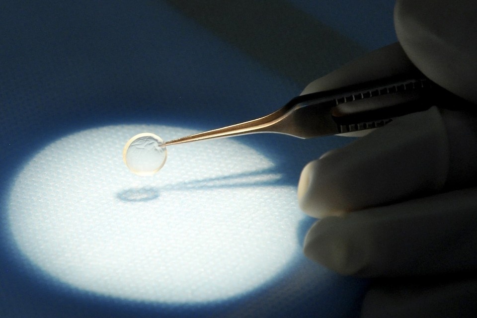    При разрыве роговицы врачи пересаживают человеку донорскую. Фото: РОКБ.