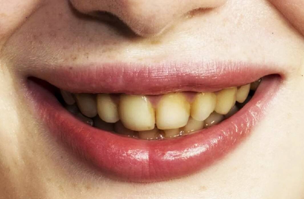 Эстетические проблемы это верхушка айсберга