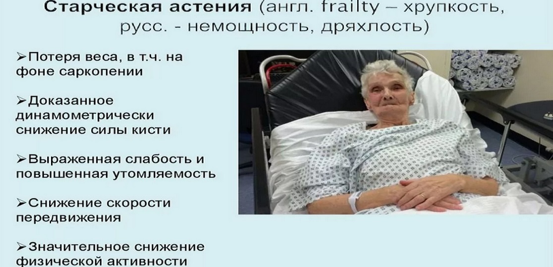 СТАРОСТЬ.. Старческая астения. (Яндекс Картинки - dc113.ru)