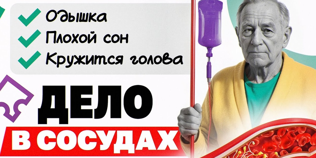 7 признаков, что сосуды мозга стареют быстрее возраста (чек-лист)