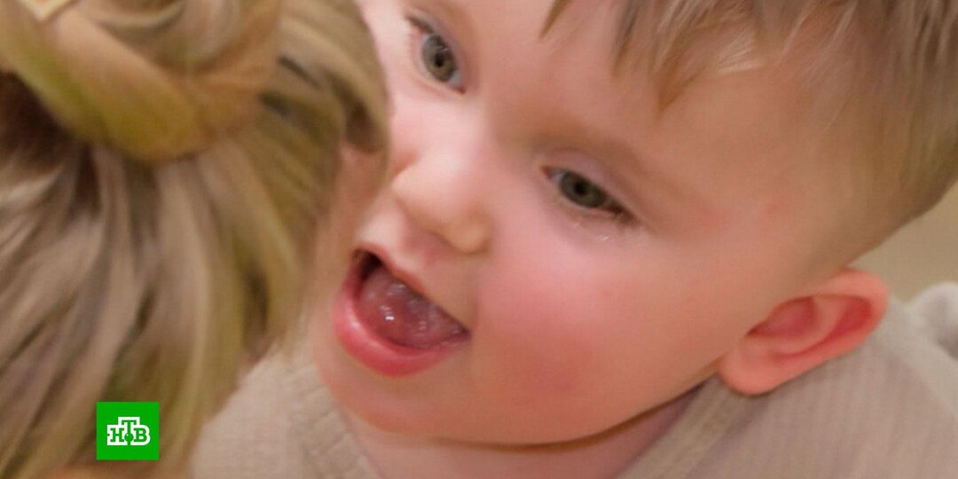 Двухлетнему Марку нужна помощь в борьбе с тяжелым поражением мозга