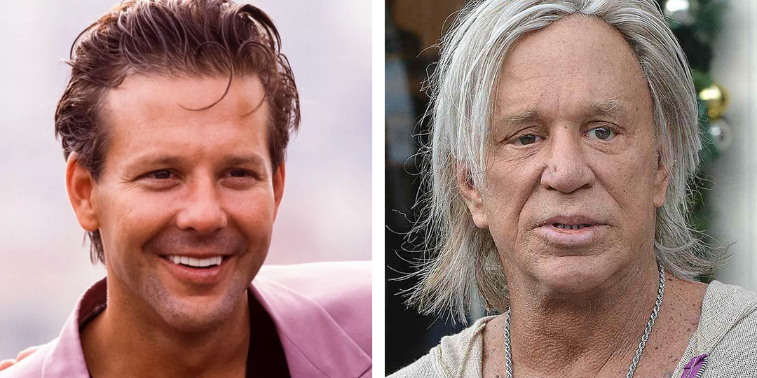 9 актеров, карьера которых уже никогда не была прежней после пластики