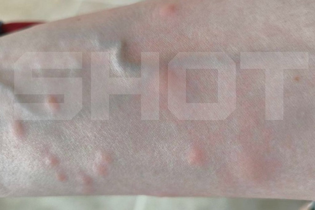    Фото © Telegram / SHOT