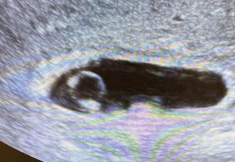 Вы слишком рано пришли