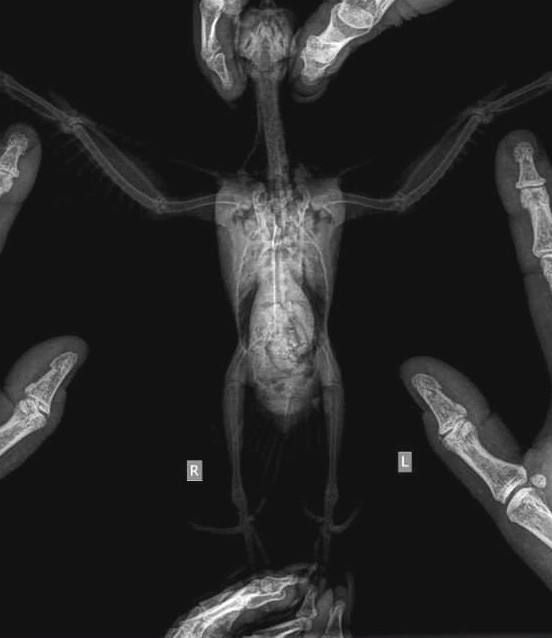 Рентген из второй клиники, в 4 руки.