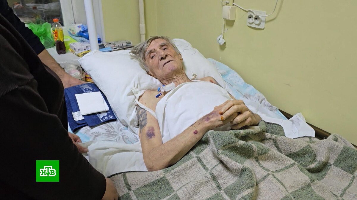    Коммунальщики Обнинска не признают вину за сварившегося в кипятке пенсионера