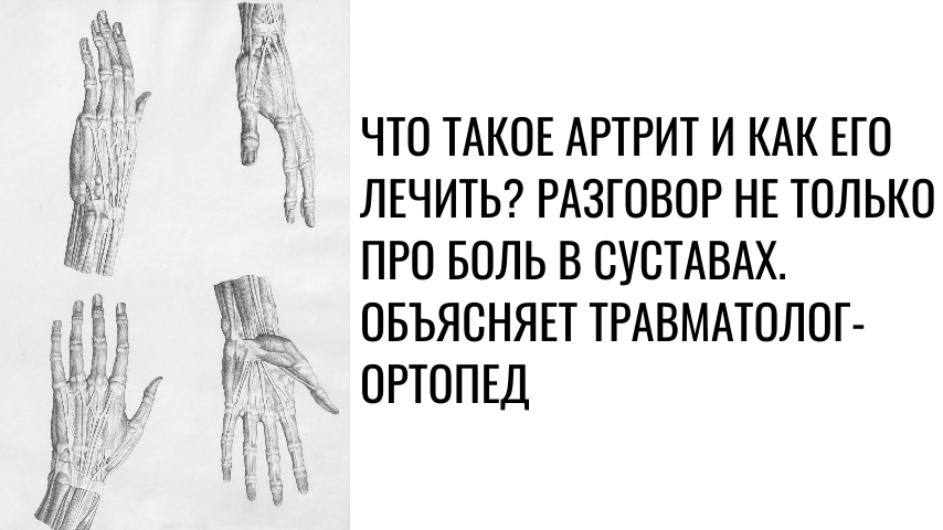 Что такое артрит и как его лечить? Разговор не только про боль в суставах. Объясняет травматолог-ортопед