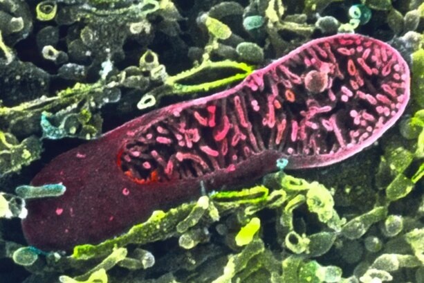 Раковые опухоли «воруют электростанции» у клеток иммунитета