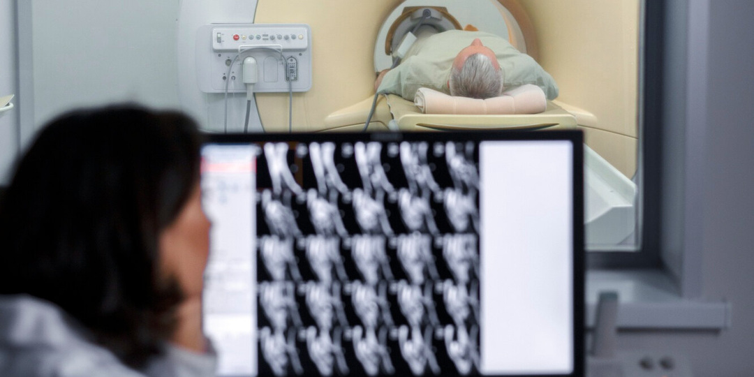 Ученые обнаружили механизм, позволяющий раку поджелудочной железы распространяться по нервам