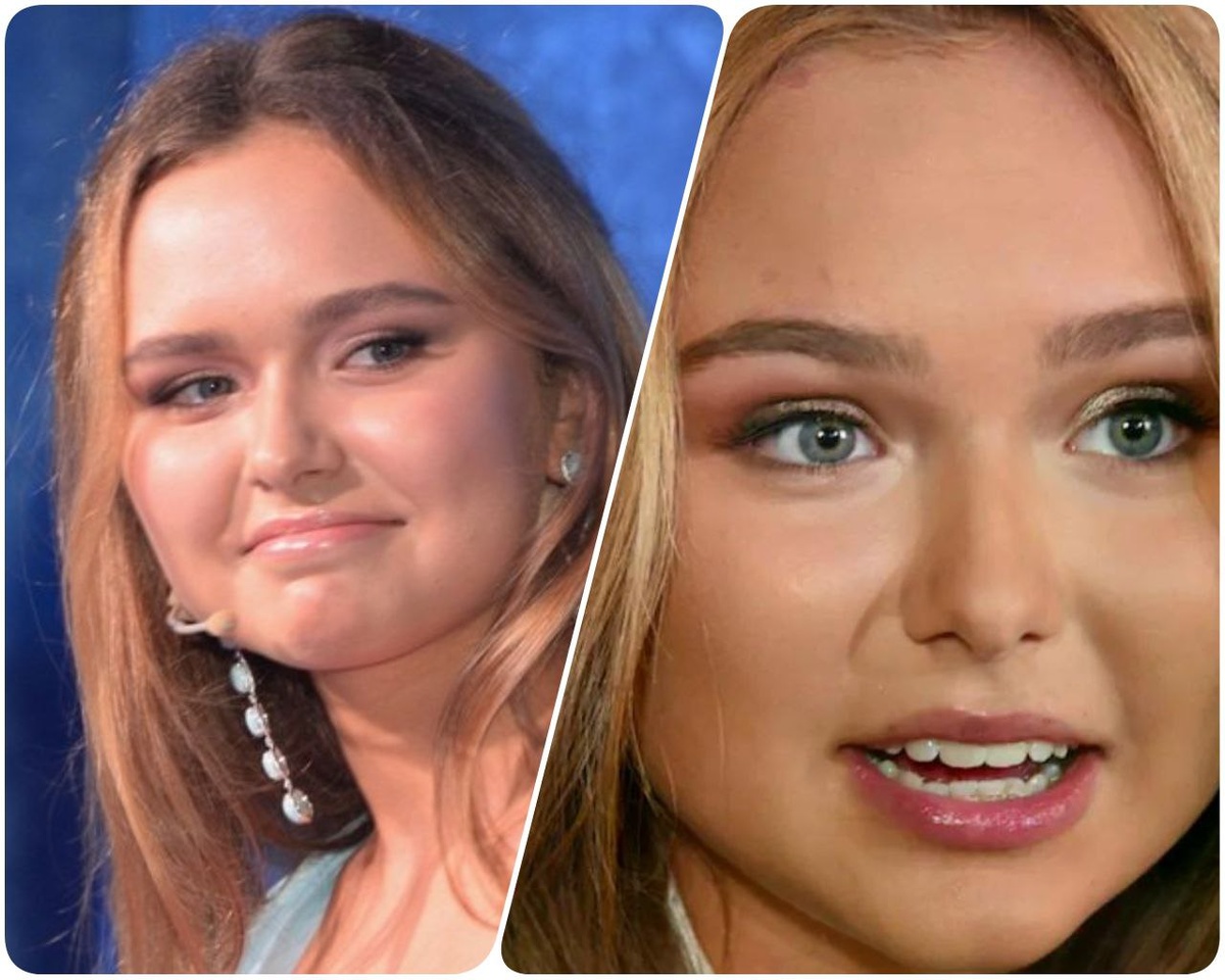 Здесь Стефания Маликова еще до ринопластики (исправления носа), но губы потихоньку уже увеличивает