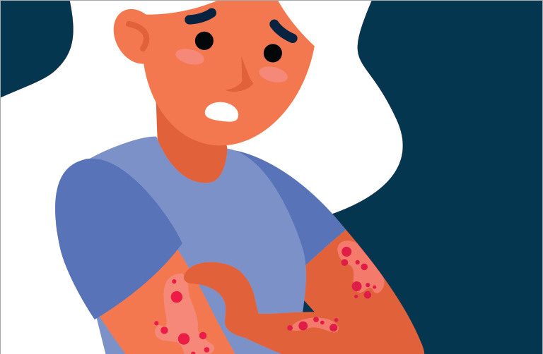 Псориаз и психика: ключевые механизмы и клинические следствия