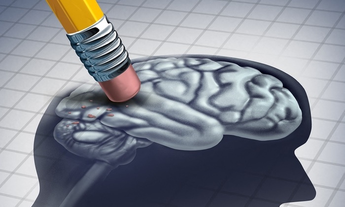    Лазерный «стиратель памяти»