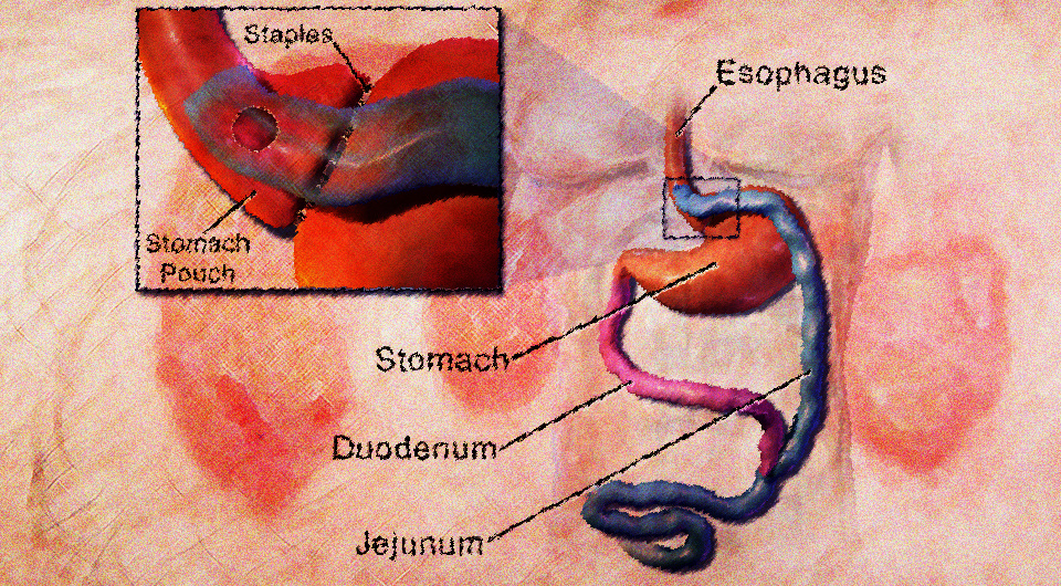   N + 1; Blausen Medical / Wikimedia Commons / CC-BY-3.0; paul-hat-schuppenflechte / Wikimedia Commons / CC-BY-SA-3.0