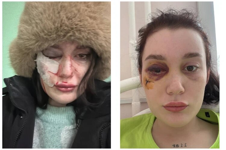 Марьяна в больнице и дома после операции