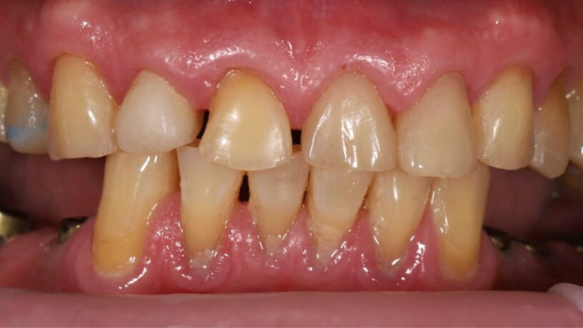 Фото до проведенных работ. 