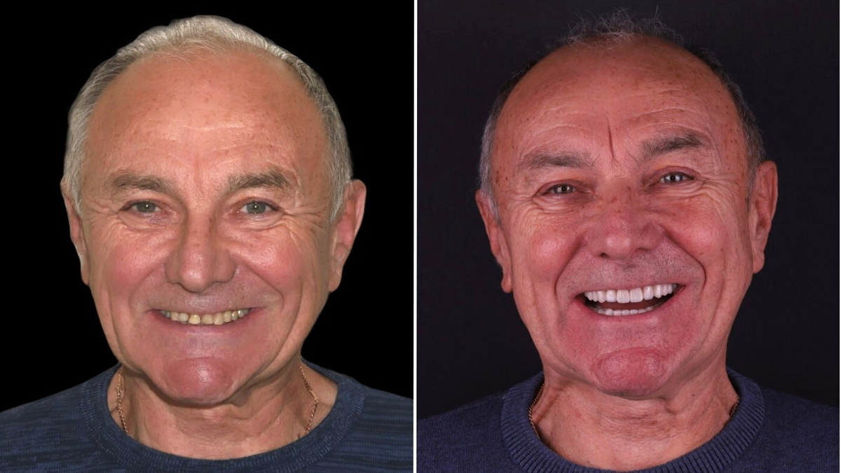 До  и после.