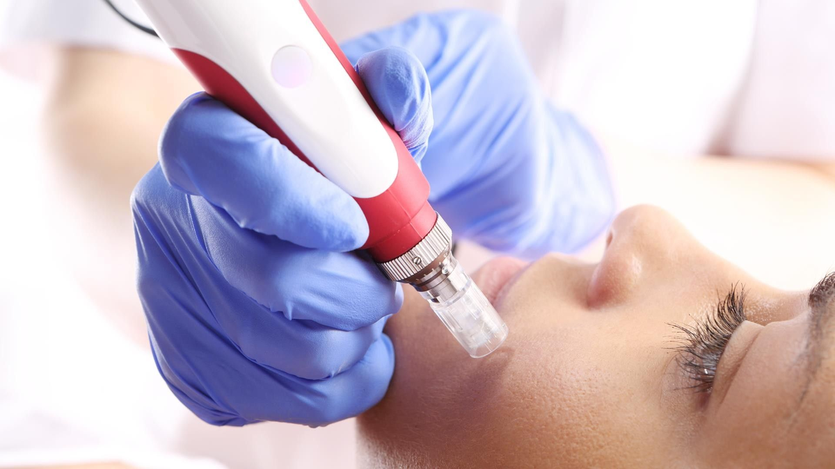 Относительные ограничения — это ситуации, когда дермапен лучше временно отложить, чтобы не получить раздражение, пигментацию и лишнюю нагрузку на кожу.