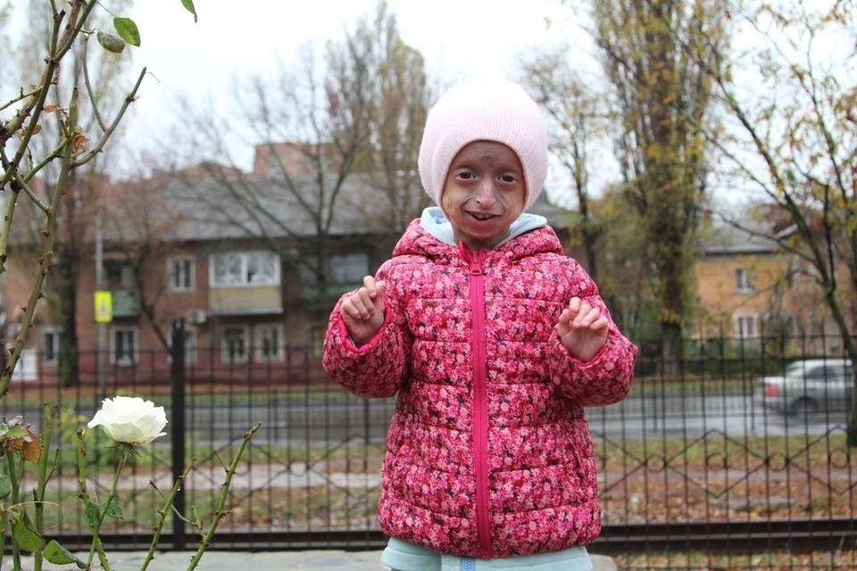    Редкое генетическое заболевание заставляет организм Мелании преждевременно стареть Мария ГИЧЕНКО