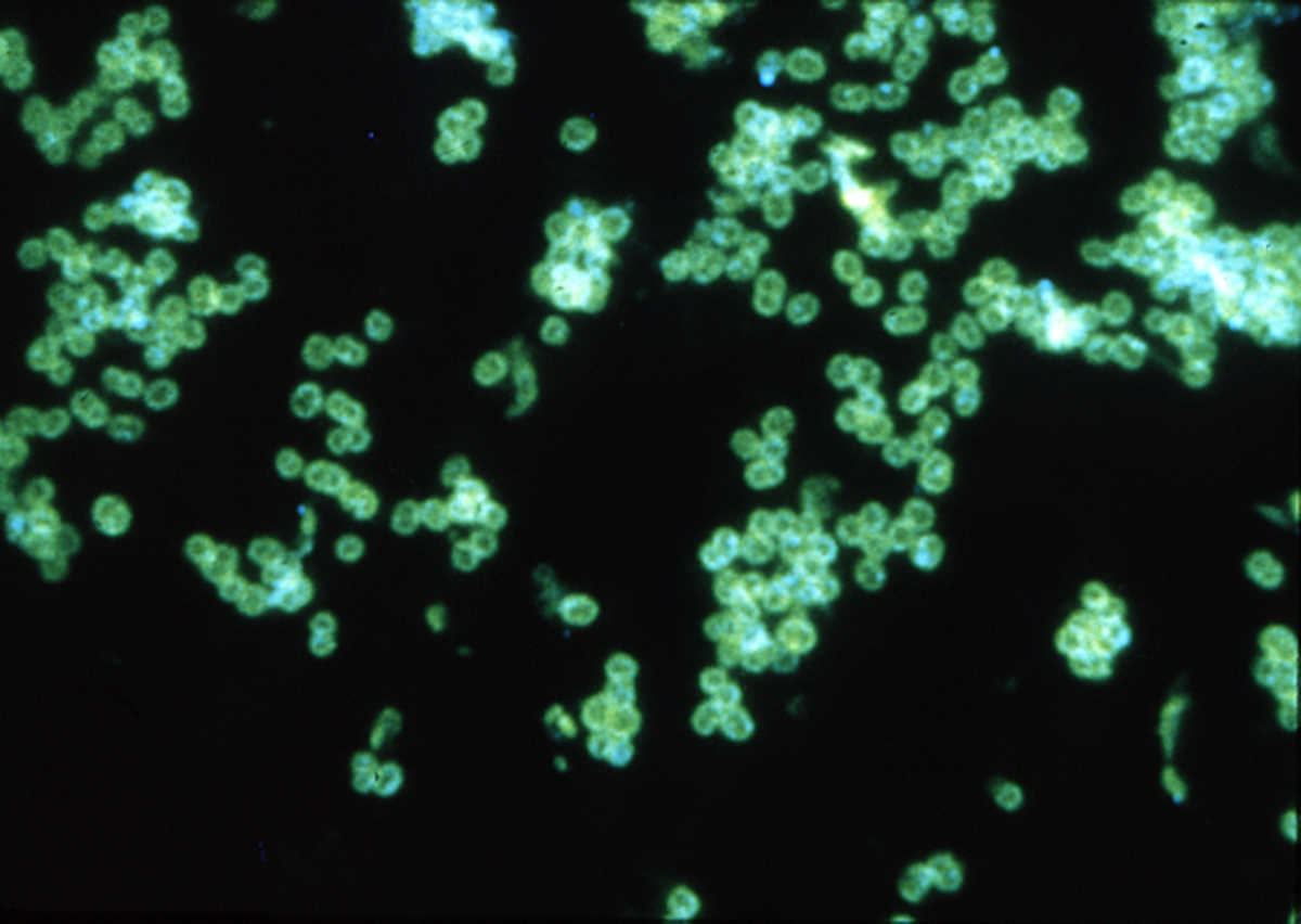    Тестирование титра антител с помощью флуоресцентных меток