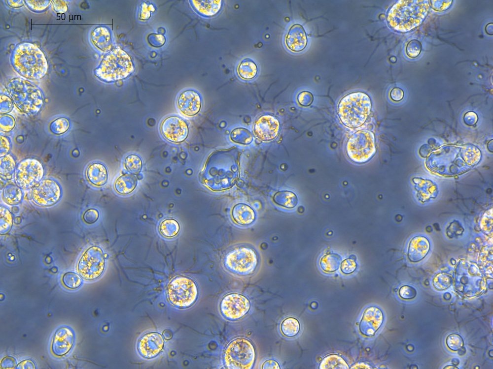    Микроскопическое исследование хитридиевого гриба Batrachochytrium dendrobatidis.
