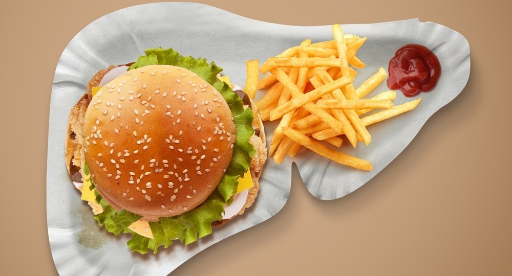 Жировой гепатоз — тихий убийца печени: симптомы и профилактика