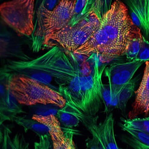    Культура кардиомиоцитов / © Айгуль Низамиева, пресс-служба МФТИ