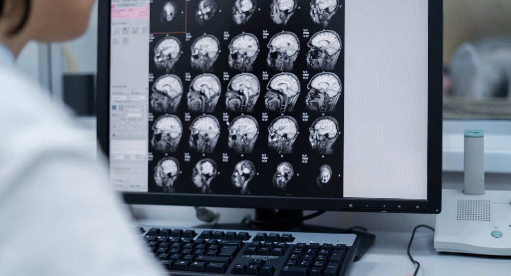 В Казахстане 768 тысяч мужчин пошли проверяться на рак шейки матки