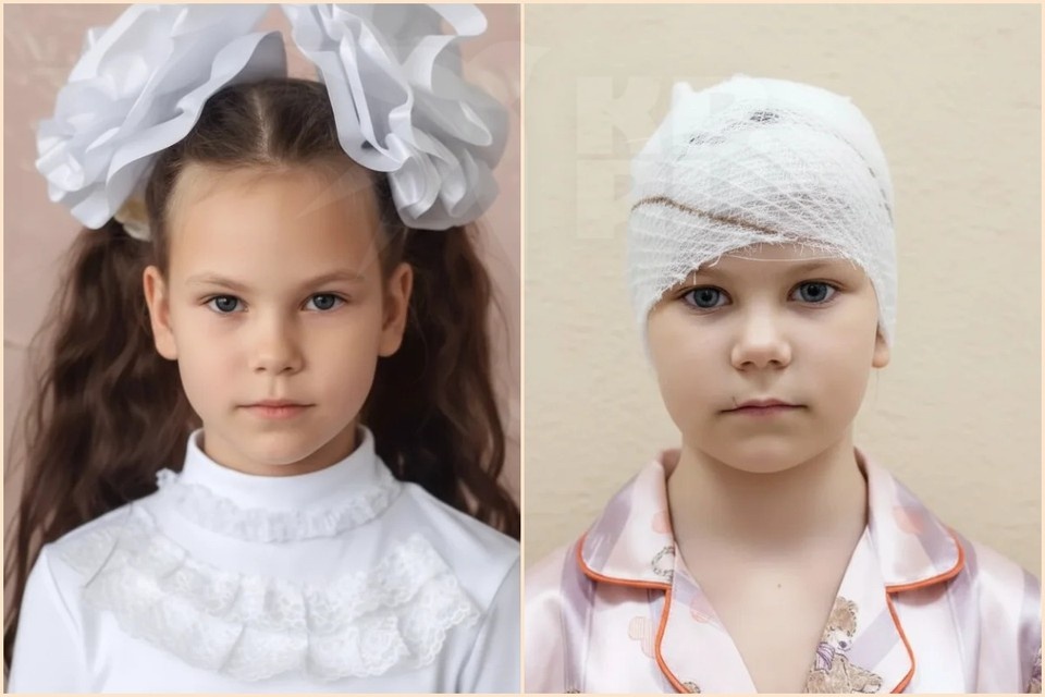    Кате из Черногорска предстоит пережить еще не одну операцию. Фото: архив семьи.