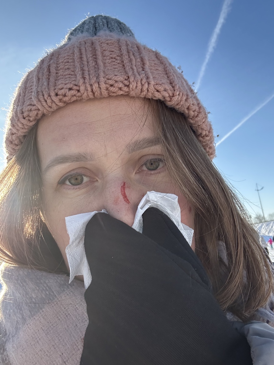 Сделала фото на память для себя, чтобы запомнить, что опасное развлечение эти ваши «плюшки».