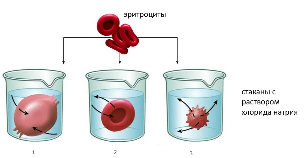Вода по закону осмоса пойдет туда, где соли больше.
1 стакан - Раствор < 0,9% (Соли мало / пресная вода, дистиллированная-гипотонический раствор) - вода идет в клетку, поэтому  объем клетки — 1 (увеличится). Концентрация соли внутри клетки— 2 (уменьшится). Воды станет много (объём увеличивается)  и концентрация соли станет меньше. Эритроциты набухают, могут лопнуть.                                                                                        2 стакан -Раствор = 0,9% (соли соответсвует норме /физраствор) - все показатели не изменяются      3 стакан - Раствор > 0,9% (Соли много - гипертонический раствор) - вода из клетки в раствор идет, поэтому объем клетки — 2 (уменьшится). Концентрация соли внутри клетки— 1 (увеличится). Воды стало мало (объём уменьшился)  и концентрация соли стала больше.