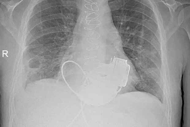    Фото: lenta.ru Мария Михайлова