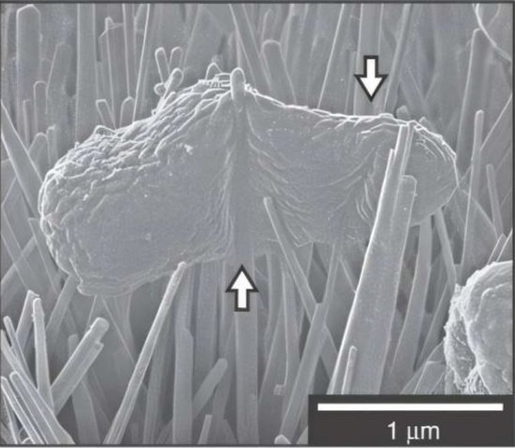 Клетка Klebsiella pneumoniae, пронзенная наношипами. Источник: Jenkins, J., et al./Nature Communications, 2020 via a CC BY 4.0 license.📷    Крылья насекомых вдохновили ученых на прокалывание патогенных бактерий
