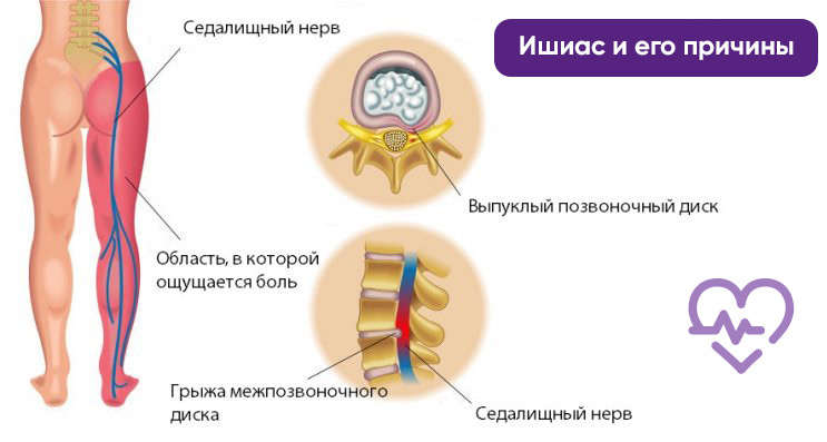 Яндекс Картинки