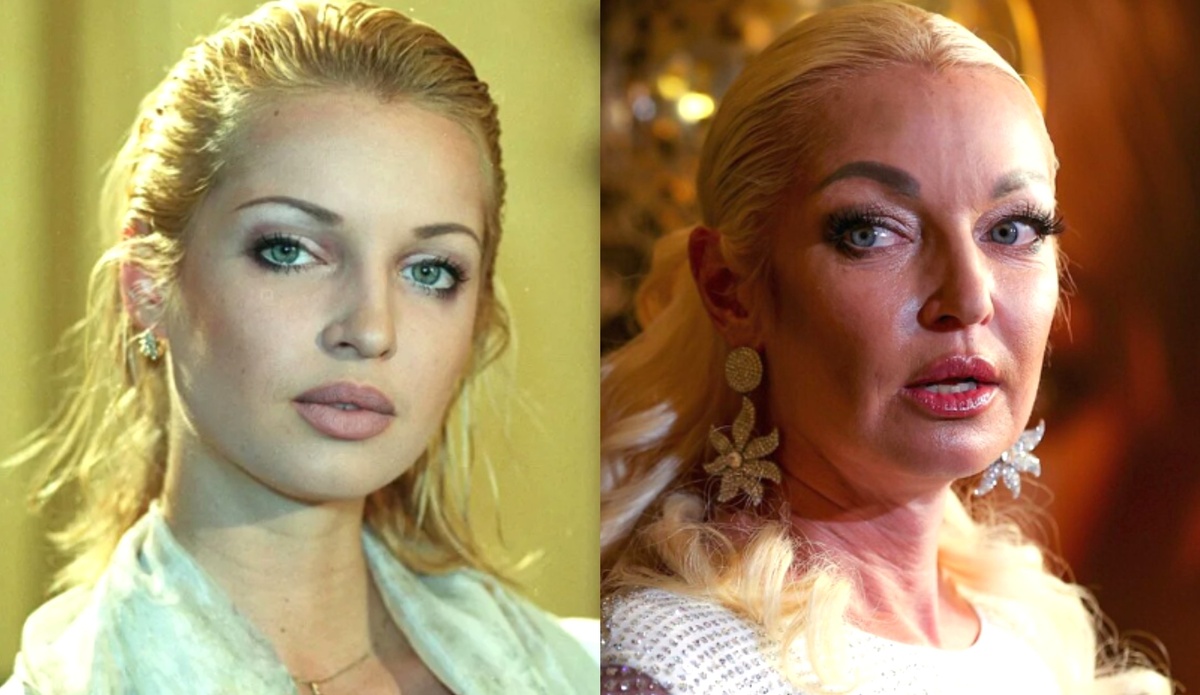 на фото Анастасия Волочкова в молодости и сейчас