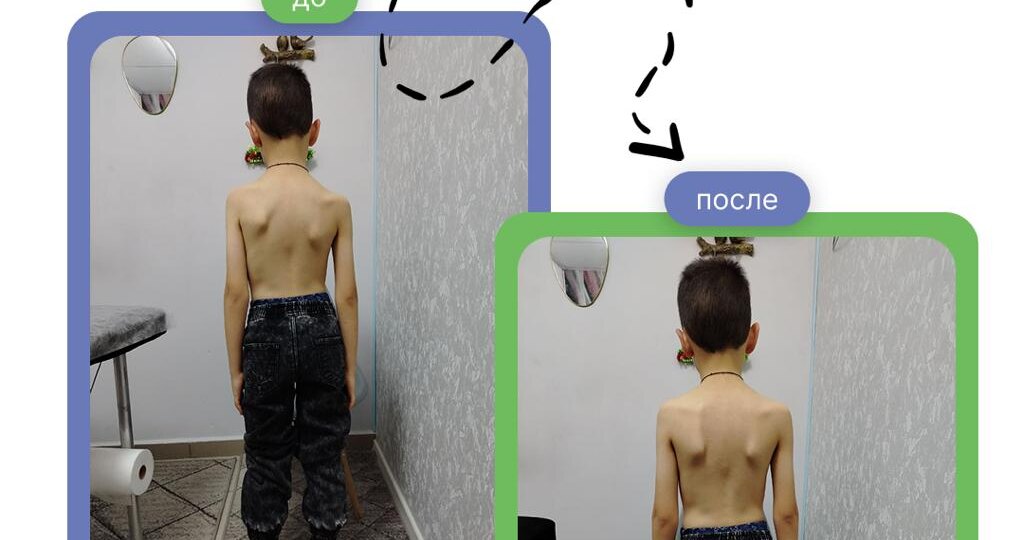 Остеопатия всё теснее входит в нашу жизнь