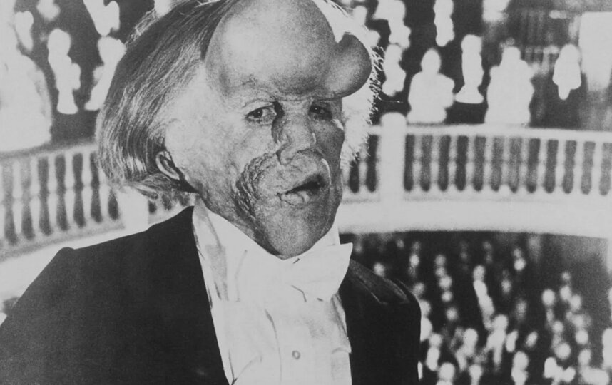    Грим Джона Херта был создан на основе представленного в Королевской больнице Лондона заспиртованного тела Джозефа Меррика. Накладка грима каждый день занимала 12 часов.Кадр из фильма "Человек-слон", Paramount Pictures