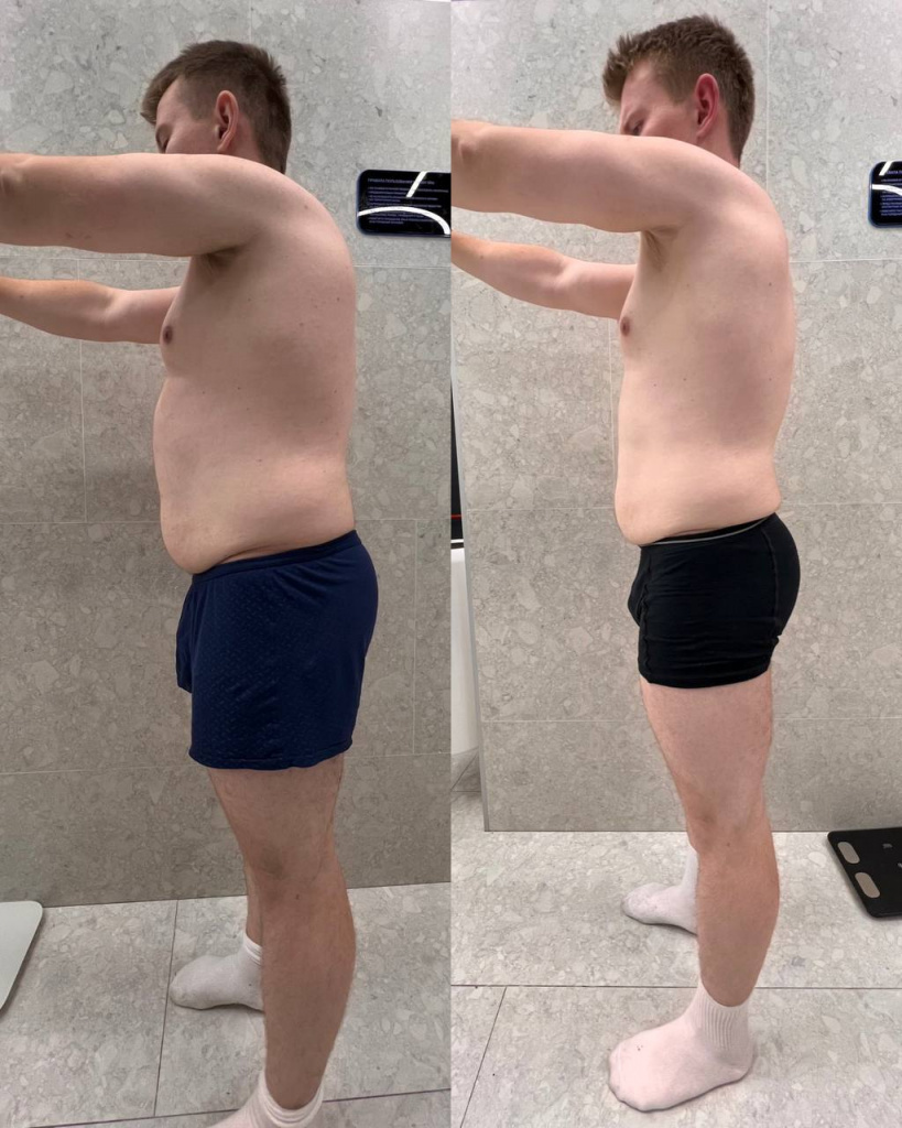 Результат ДО и ПОСЛЕ 