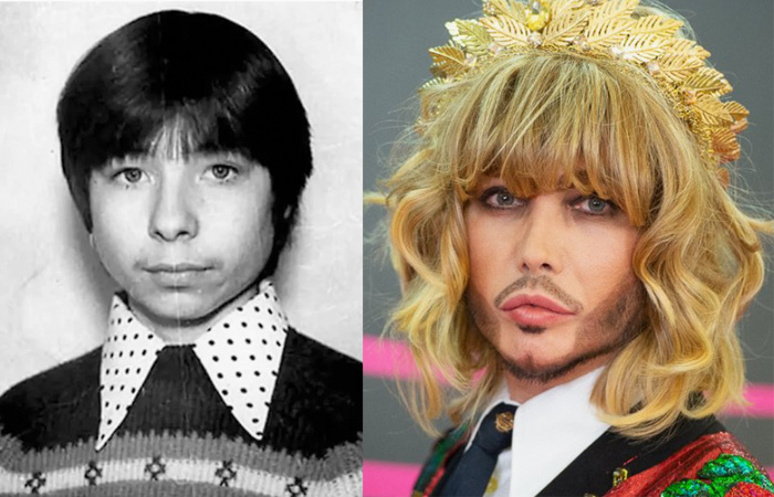 Сергей Зверев сделал много пластических операций.