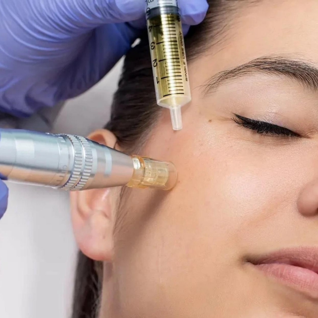 Чтобы результат дермапена держался дольше, важно поддерживать кожу мягким уходом, восстановлением барьера, ежедневным SPF и аккуратным введением активов без перегруза.