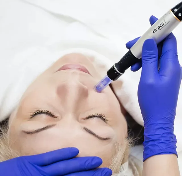 Дермапен — деликатная процедура, которая мягко обновляет кожу, выравнивает рельеф и тон, уменьшает поры и следы постакне без изменения черт лица.